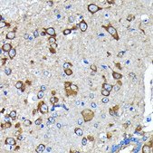 Anti-Huntingtin antibody produced in rabbit