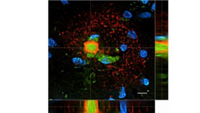 Anti-Amyloid Beta 3NTyr10 Antibody, clone 4A5E8 clone 4A5E8, from mouse