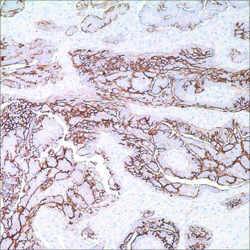 CA-125 (OC125) Mouse Monoclonal Antibody