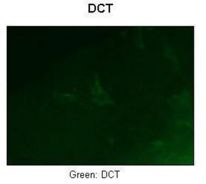 Anti-DCT antibody produced in rabbit affinity isolated antibody