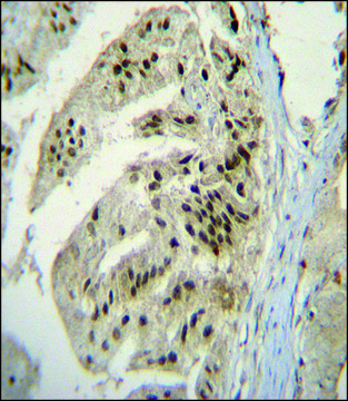 ANTI-PAP (CENTER) antibody produced in rabbit IgG fraction of antiserum, buffered aqueous solution