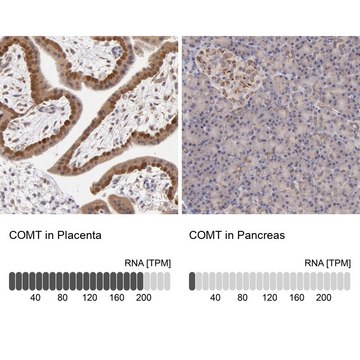 Anti-COMT antibody produced in rabbit Prestige Antibodies&#174; Powered by Atlas Antibodies, affinity isolated antibody, buffered aqueous glycerol solution