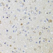 Anti-beta 2 Microglobulin antibody produced in rabbit