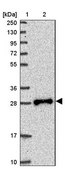 Anti-TPD52L2 antibody produced in rabbit Prestige Antibodies® Powered by Atlas Antibodies, affinity isolated antibody, buffered aqueous glycerol solution