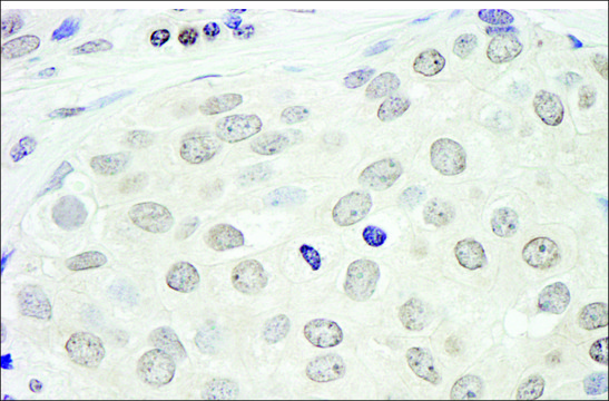 Rabbit anti-BRD2 Antibody, Affinity Purified Powered by Bethyl Laboratories, Inc.