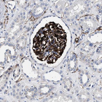 Anti-OLFML2A antibody produced in rabbit Prestige Antibodies&#174; Powered by Atlas Antibodies, affinity isolated antibody, buffered aqueous glycerol solution, Ab2