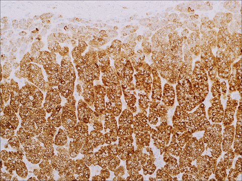 Steroidogenic Acute Regulatory Protein (STAR) (EP226) Rabbit Monoclonal Primary Antibody