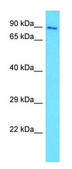 Anti-FURIN (N-terminal) antibody produced in rabbit affinity isolated antibody