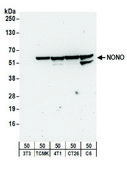 Rabbit anti-NONO Antibody, Affinity Purified Powered by Bethyl Laboratories, Inc.