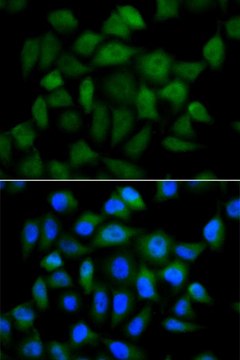 Anti-AFP antibody produced in rabbit