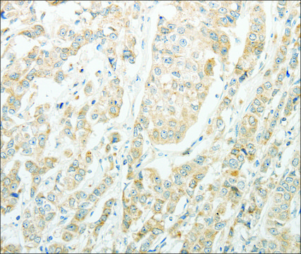 Anti-AGBL1 antibody produced in rabbit affinity isolated antibody