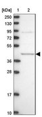 Anti-MVD antibody produced in rabbit Prestige Antibodies® Powered by Atlas Antibodies, affinity isolated antibody, buffered aqueous glycerol solution