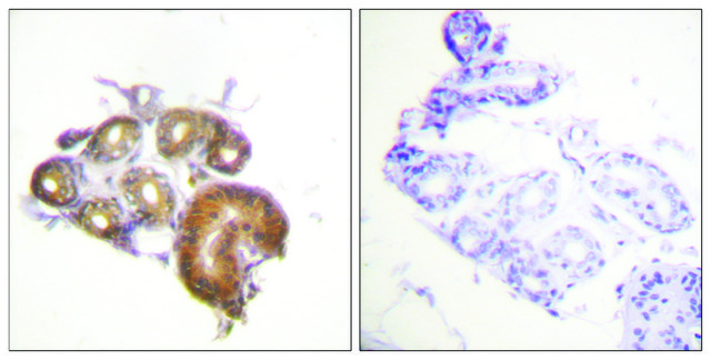 Anti-ETK antibody produced in rabbit affinity isolated antibody