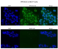 Anti-PPP1R10 antibody produced in rabbit affinity isolated antibody