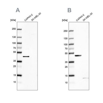 Anti-COQ2 antibody produced in rabbit Prestige Antibodies&#174; Powered by Atlas Antibodies, affinity isolated antibody