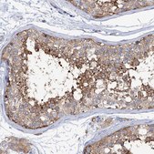 Anti-TRIM55 antibody produced in rabbit Prestige Antibodies® Powered by Atlas Antibodies, affinity isolated antibody, buffered aqueous glycerol solution