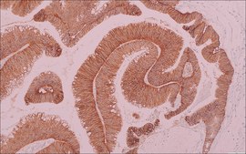 TROP2 (EP431) Rabbit Monoclonal Primary Antibody