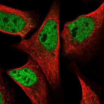 Anti-SPIDR antibody produced in rabbit affinity isolated antibody