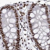 Anti-NUMA1 antibody produced in rabbit Prestige Antibodies® Powered by Atlas Antibodies, affinity isolated antibody, buffered aqueous glycerol solution