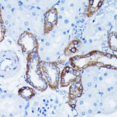 Anti-IκBα Antibody, clone 9H7X4, Rabbit Monoclonal