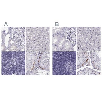 Anti-MAGEB2 Prestige Antibodies&#174; Powered by Atlas Antibodies, affinity isolated antibody