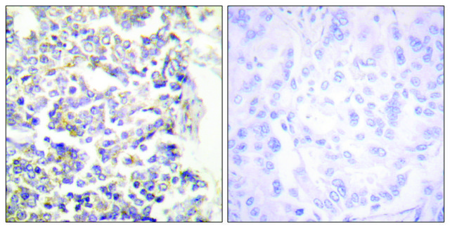 Anti-MARK3 antibody produced in rabbit affinity isolated antibody