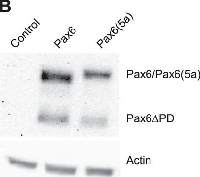 抗PAX6抗体 from rabbit, purified by affinity chromatography