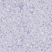 Anti-TMEM161B antibody produced in rabbit Prestige Antibodies® Powered by Atlas Antibodies, affinity isolated antibody, buffered aqueous glycerol solution