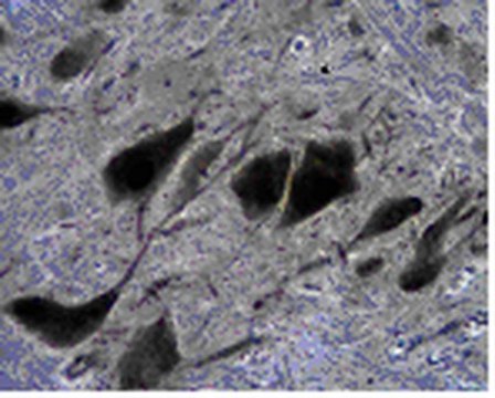 Anti-Tryptophan hydroxylase 2 Antibody from rabbit, purified by affinity chromatography