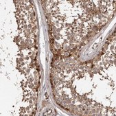 Anti-ADAMTS2 antibody produced in rabbit Prestige Antibodies® Powered by Atlas Antibodies, affinity isolated antibody, buffered aqueous glycerol solution