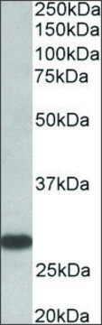 Anti-TSHR antibody produced in goat affinity isolated antibody, buffered aqueous solution