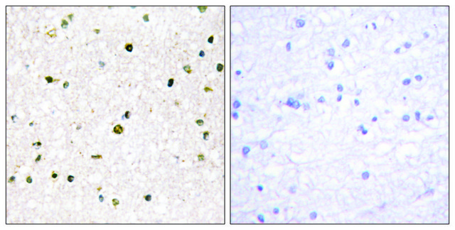 Anti-AKAP11 antibody produced in rabbit affinity isolated antibody