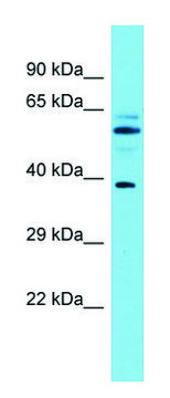 Anti-MACROD1 (N-terminal) antibody produced in rabbit affinity isolated antibody