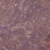 Anti-GSKIP antibody produced in rabbit Prestige Antibodies® Powered by Atlas Antibodies, affinity isolated antibody, buffered aqueous glycerol solution