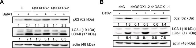 Anti-LC3 antibody produced in rabbit ~1&#160;mg/mL, affinity isolated antibody, buffered aqueous solution