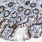 Anti-DUSP19 antibody produced in rabbit Prestige Antibodies® Powered by Atlas Antibodies, affinity isolated antibody, buffered aqueous glycerol solution