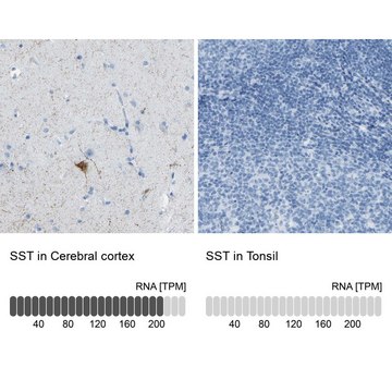 抗-SST 兔抗 affinity isolated antibody, buffered aqueous glycerol solution