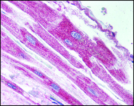 Anti-USP18 antibody produced in rabbit affinity isolated antibody, buffered aqueous solution