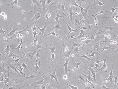 Mouse OP9-DL4 Delta-like 4 Notch Ligand Cell Line