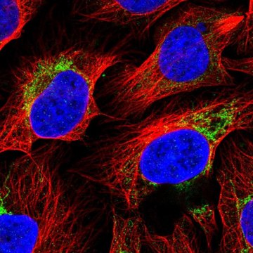 Anti-ACSS3 antibody produced in rabbit Prestige Antibodies&#174; Powered by Atlas Antibodies, affinity isolated antibody