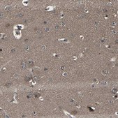 Anti-MYO18A antibody produced in rabbit Prestige Antibodies® Powered by Atlas Antibodies, affinity isolated antibody, buffered aqueous glycerol solution, Ab2