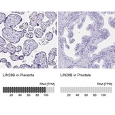 Anti-LIN28B antibody produced in rabbit Prestige Antibodies® Powered by Atlas Antibodies, affinity isolated antibody, buffered aqueous glycerol solution
