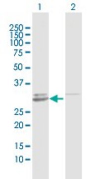 Anti-GALNT12 antibody produced in rabbit purified immunoglobulin, buffered aqueous solution