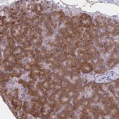 Anti-CEMP1 antibody produced in rabbit Prestige Antibodies® Powered by Atlas Antibodies, affinity isolated antibody, buffered aqueous glycerol solution
