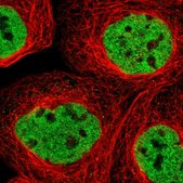 Anti-PHF12 antibody produced in rabbit Prestige Antibodies® Powered by Atlas Antibodies, affinity isolated antibody, buffered aqueous glycerol solution