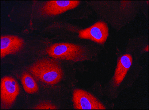 Anti-HRD1/SYVN1 antibody produced in rabbit ~1.0&#160;mg/mL, affinity isolated antibody, buffered aqueous solution