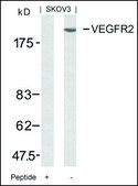 Anti-KDR (Ab-951) antibody produced in rabbit affinity isolated antibody
