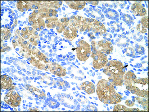 Anti-RAE1 (AB1) antibody produced in rabbit affinity isolated antibody