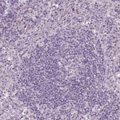 Anti-NAT8 Prestige Antibodies® Powered by Atlas Antibodies, affinity isolated antibody