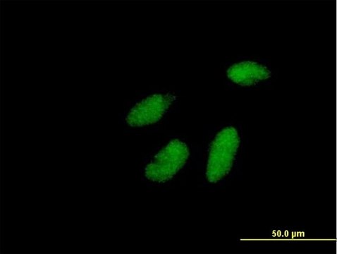 Anti-RAD1 antibody produced in mouse purified immunoglobulin, buffered aqueous solution